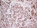 FTO Antibody in Immunohistochemistry (Paraffin) (IHC (P))