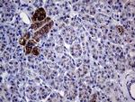 GALNT10 Antibody in Immunohistochemistry (Paraffin) (IHC (P))