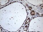 XRN2 Antibody in Immunohistochemistry (Paraffin) (IHC (P))