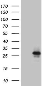 IL24 Antibody in Western Blot (WB)