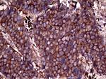 RPL10A Antibody in Immunohistochemistry (Paraffin) (IHC (P))