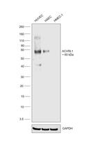 ACVRL1 Antibody in Western Blot (WB)