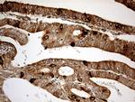 KDELC2 Antibody in Immunohistochemistry (Paraffin) (IHC (P))