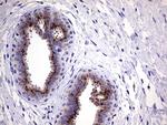 Myotilin Antibody in Immunohistochemistry (Paraffin) (IHC (P))