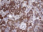 Myotilin Antibody in Immunohistochemistry (Paraffin) (IHC (P))