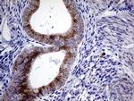 Myotilin Antibody in Immunohistochemistry (Paraffin) (IHC (P))