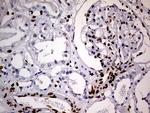 MEIS1 Antibody in Immunohistochemistry (Paraffin) (IHC (P))