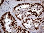 MEIS1 Antibody in Immunohistochemistry (Paraffin) (IHC (P))