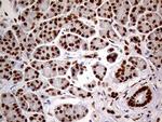 MEIS1 Antibody in Immunohistochemistry (Paraffin) (IHC (P))