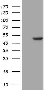 WDR77 Antibody in Western Blot (WB)