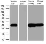 CBR1 Antibody in Western Blot (WB)