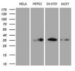 CBR1 Antibody in Western Blot (WB)