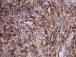 DGKZ Antibody in Immunohistochemistry (Paraffin) (IHC (P))