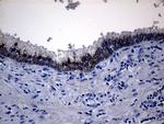 ROR2 Antibody in Immunohistochemistry (Paraffin) (IHC (P))