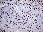 TSEN34 Antibody in Immunohistochemistry (Paraffin) (IHC (P))