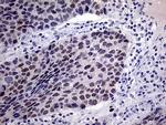 TSEN34 Antibody in Immunohistochemistry (Paraffin) (IHC (P))