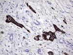 ZRANB1 Antibody in Immunohistochemistry (Paraffin) (IHC (P))