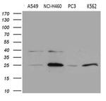 CHP1 Antibody in Western Blot (WB)