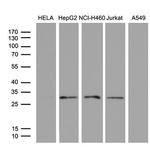 PSMD9 Antibody in Western Blot (WB)