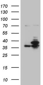 PPP4C Antibody in Western Blot (WB)