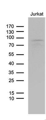 LZTS1 Antibody in Western Blot (WB)