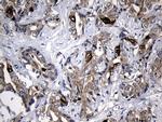 RRM2 Antibody in Immunohistochemistry (Paraffin) (IHC (P))