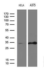 RPAIN Antibody in Western Blot (WB)