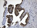 CPT1B Antibody in Immunohistochemistry (Paraffin) (IHC (P))