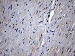 CPT1B Antibody in Immunohistochemistry (Paraffin) (IHC (P))