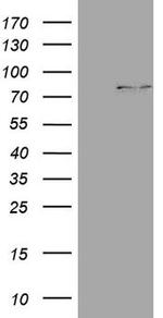 CPT1B Antibody in Western Blot (WB)