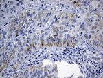 NDUFA4L2 Antibody in Immunohistochemistry (Paraffin) (IHC (P))