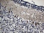 DNAJB6 Antibody in Immunohistochemistry (Paraffin) (IHC (P))