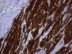 NAT1 Antibody in Immunohistochemistry (Paraffin) (IHC (P))