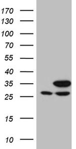 PGAM4 Antibody in Western Blot (WB)