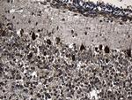 TCP-1 delta Antibody in Immunohistochemistry (Paraffin) (IHC (P))