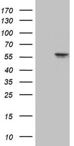 TCP-1 delta Antibody in Western Blot (WB)