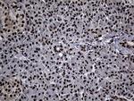 ASH2L Antibody in Immunohistochemistry (Paraffin) (IHC (P))