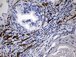 C1orf111 Antibody in Immunohistochemistry (Paraffin) (IHC (P))