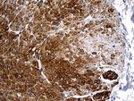 C1orf111 Antibody in Immunohistochemistry (Paraffin) (IHC (P))