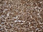 ALDH7A1 Antibody in Immunohistochemistry (Paraffin) (IHC (P))