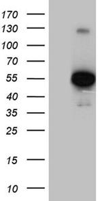 ALDH7A1 Antibody in Western Blot (WB)