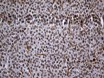 RAD21 Antibody in Immunohistochemistry (Paraffin) (IHC (P))