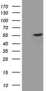 EXOC4 Antibody in Western Blot (WB)