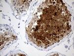 YBX2 Antibody in Immunohistochemistry (Paraffin) (IHC (P))