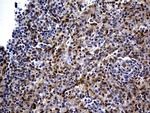 N-WASP Antibody in Immunohistochemistry (Paraffin) (IHC (P))