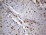 PYGM Antibody in Immunohistochemistry (Paraffin) (IHC (P))