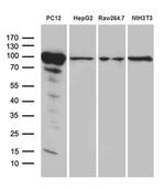 PYGM Antibody in Western Blot (WB)