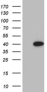 SULT1A3 Antibody in Western Blot (WB)