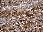 SULT1A3 Antibody in Immunohistochemistry (Paraffin) (IHC (P))