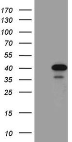 SULT1A3 Antibody in Western Blot (WB)